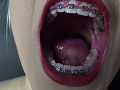 dirty talking teen shows mouth, tongue & braces