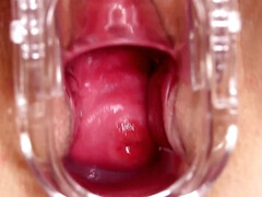 Inside Scarlett - endoscopic vaginal exam of pink vagina