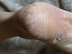 足