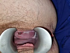 Gynäkologe, Behaart, Massage, Polisch, Spielzeuge, Unter dem rock, Vibrator, Ehefrau