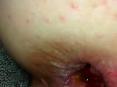 Enthousiasteling, Anaal, Gapende, Masturbatie, Alleen, Speelgoed